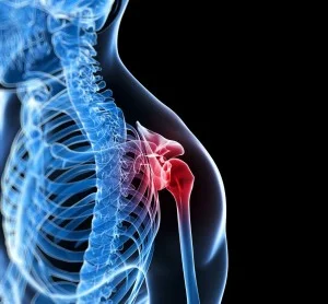 Osteoporose é a principal causa de morte acidental após os 65 anos