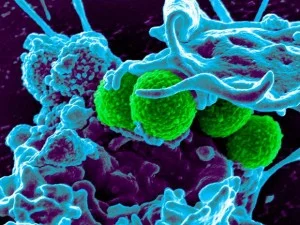 Descobertas promissoras no desenvolvimento de antibióticos