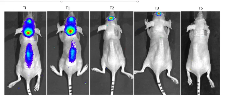 Vírus da zika pode curar tumor cerebral
