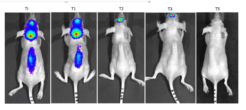 Vírus da zika pode curar tumor cerebral