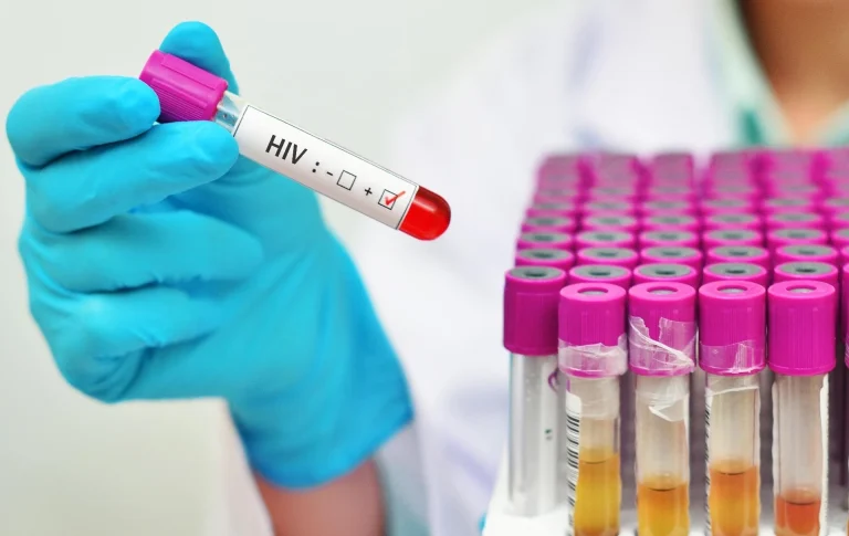 Qual a diferença entre HIV e Aids?