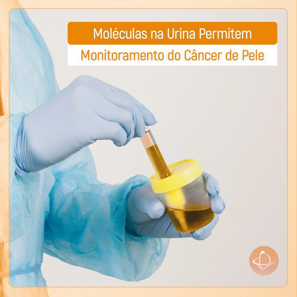 Monitoramento do câncer de pele